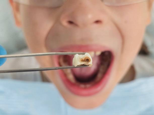 Best Emergency Cosmetic Dentistry in Colon, MI