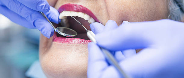 Best Emergency Dentist for Lost Fillings or Crowns in Colon, MI